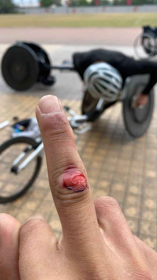 球盟会：勇夺三金！阜阳杨少桥厉害！(图5)